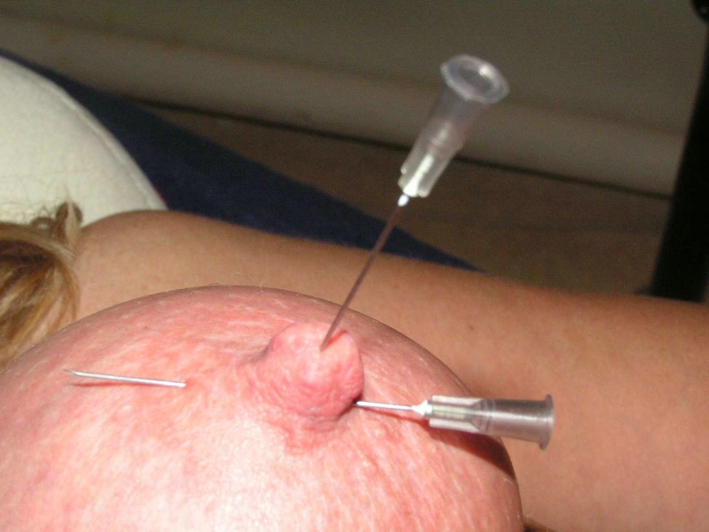Private Needle Pain Spanking picture