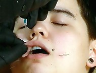 Asian Needle Pain